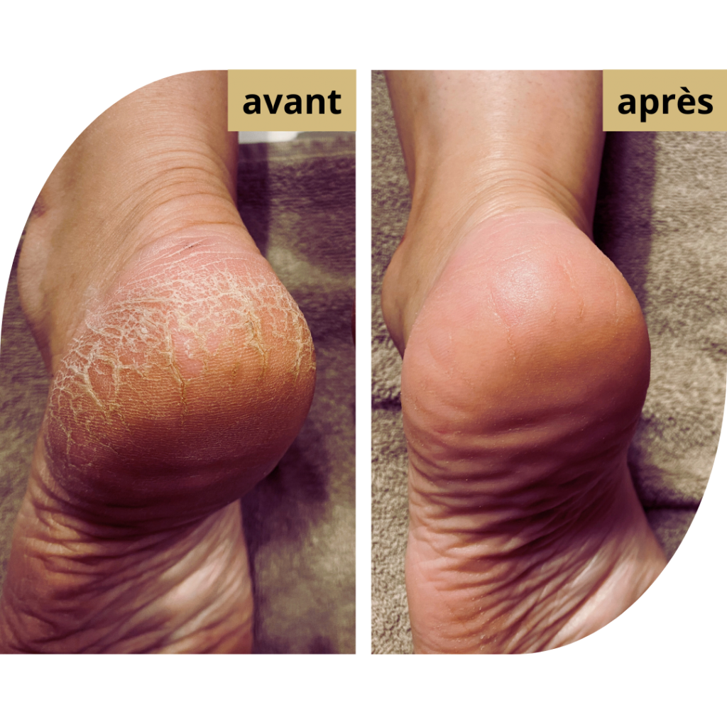 Beauté-mains-pied-callus-peeling-institut-beauté-the-beauty-shop-lyon-6